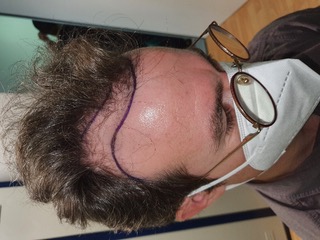 Fotos Pre-operatorias.jpg