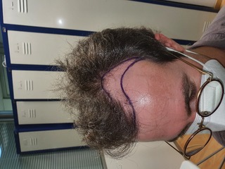 Fotos Pre-operatorias2.jpg