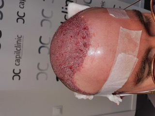 Fotos Post-operatorias.jpg
