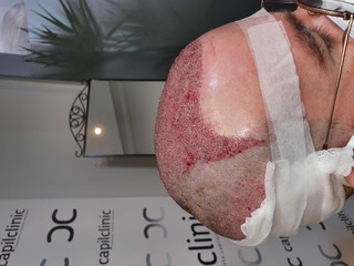 Fotos Post-operatorias2.jpg