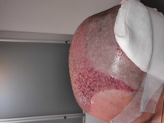 Fotos Post-operatorias3.jpg