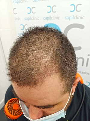 Fotos Pre-operatorias2.jpg