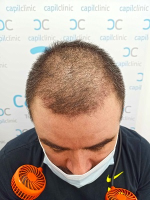 Fotos Pre-operatorias3.jpg